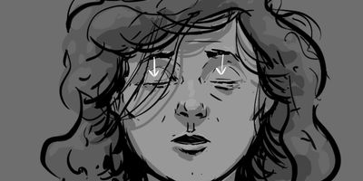 CU - Glenrose eye. Glenrose BLINKS!